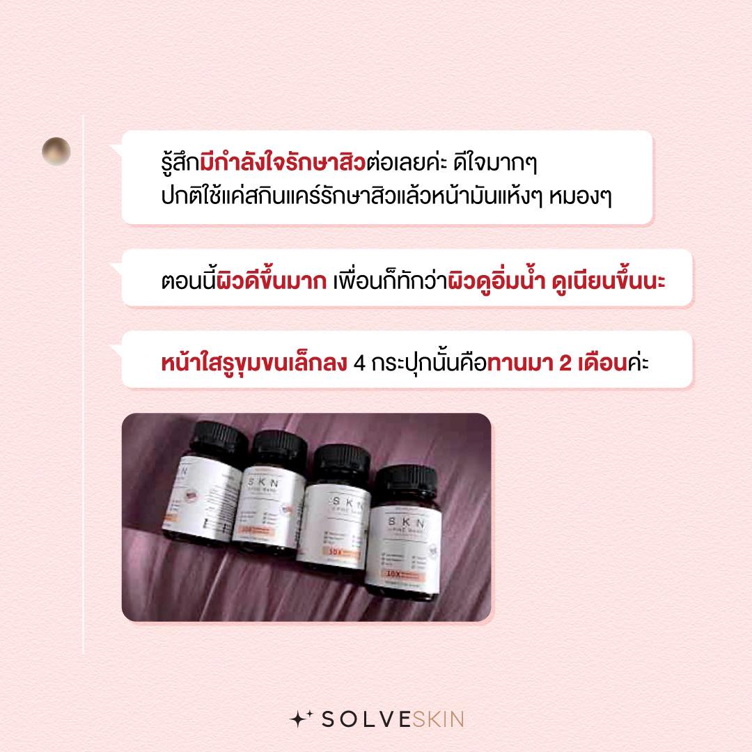 reviewskn10x SOLVE SKN Plus Pine Bark ที่ผู้ใช้จริงอยากบอกต่อ