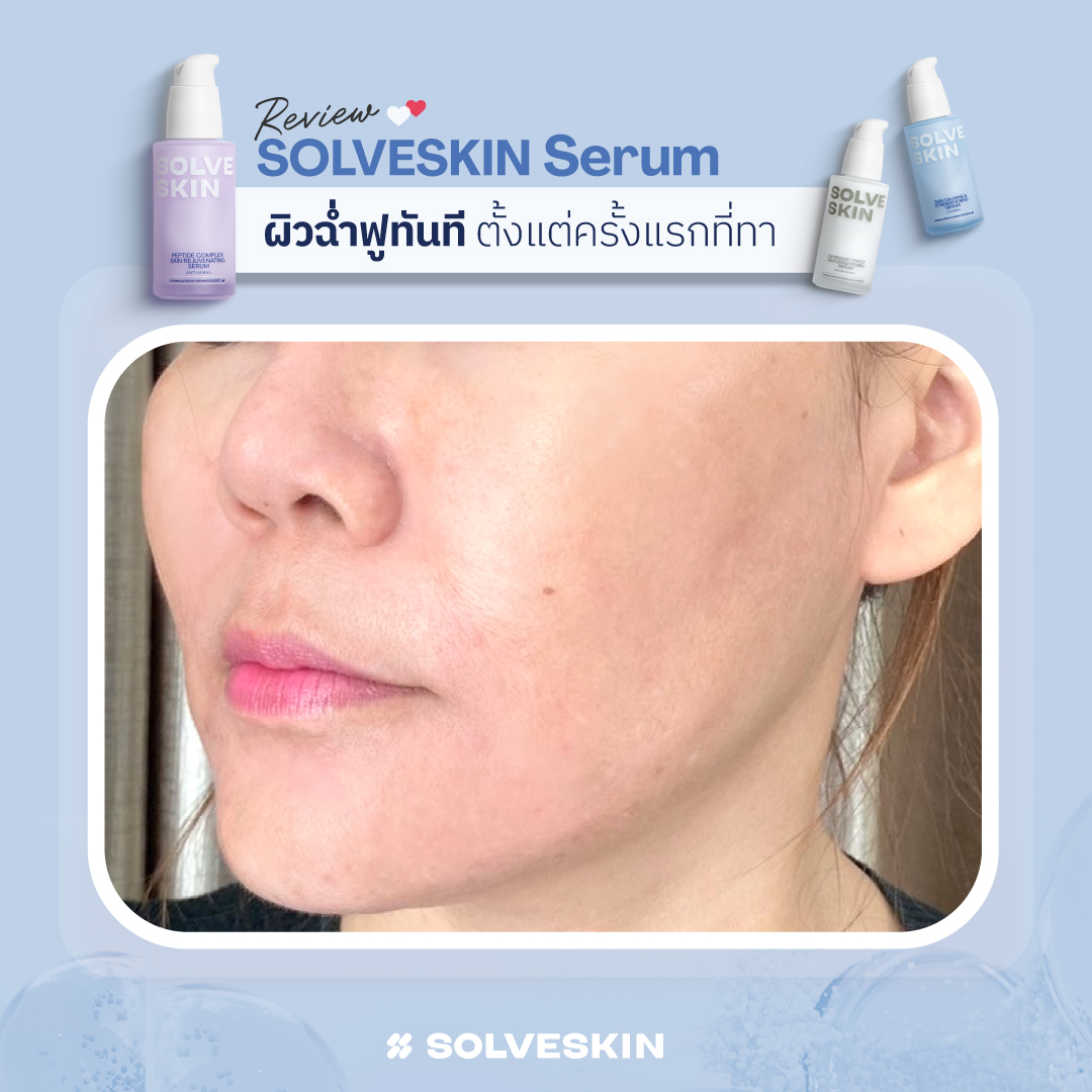 SOLVESKIN Serum Review ผิวฉ่ำฟูทันที ตั้งแต่ครั้งแรกที่ทา ชอบเปปไทด์เซรั่มมาก ผิวฉ่ำอิ่มฟู ริ้วรอยลดลงจริงจนต้องบอกต่อ ผลลัพธ์งานผิวฟูจาก ผู้ใช้จริง SOLVESKIN Serum