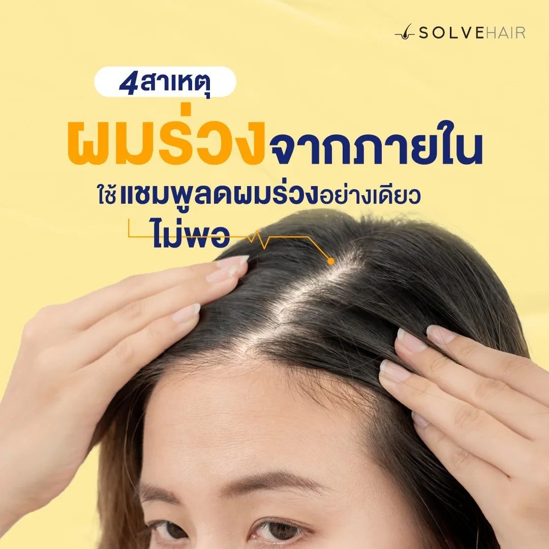 4 สาเหตุผมร่วงจากภายใน ที่ใช้ แชมพูลดผมร่วง อย่างเดียวไม่พอ