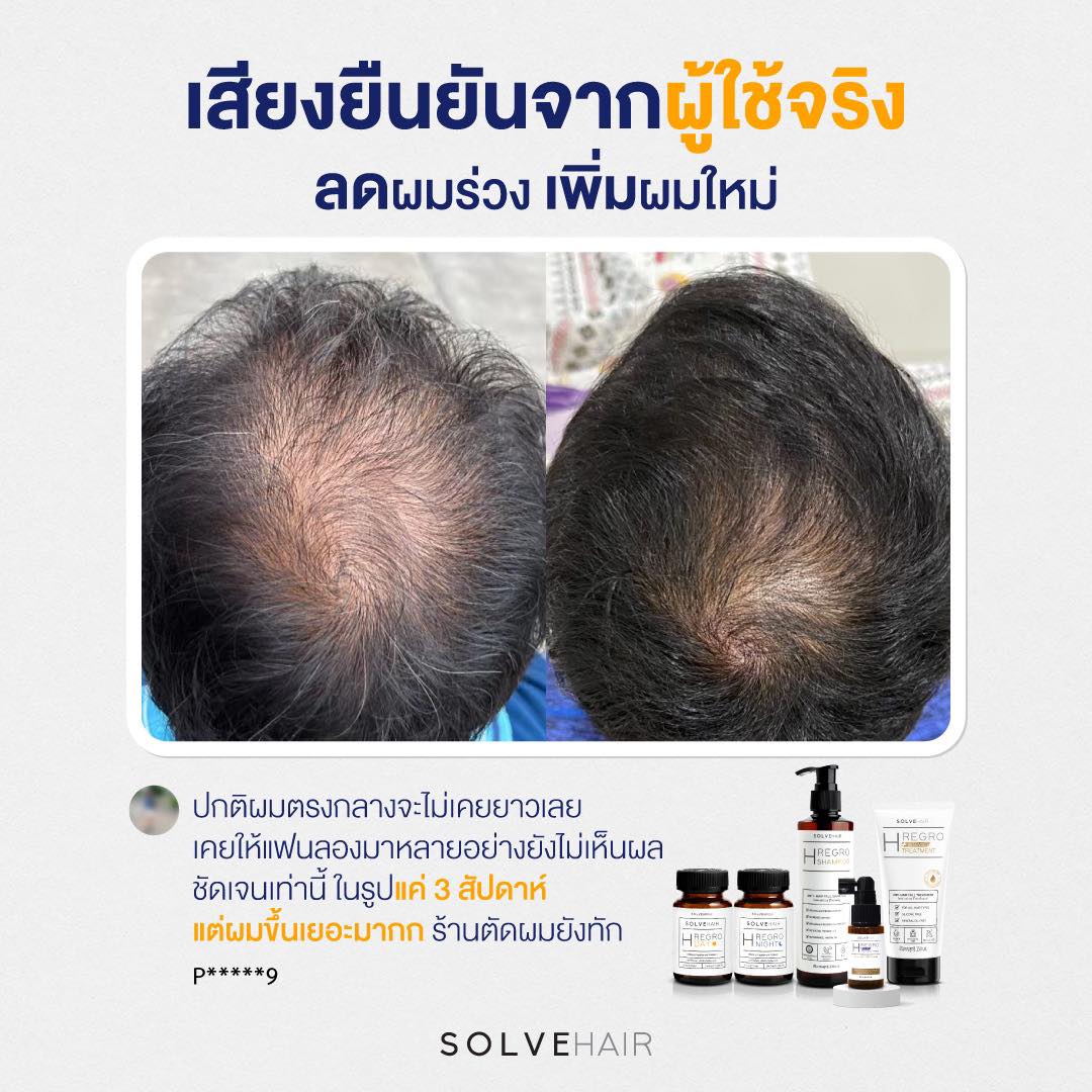 รีวิวsolvehair เสียงยืนยันจากผู้ใช้จริง