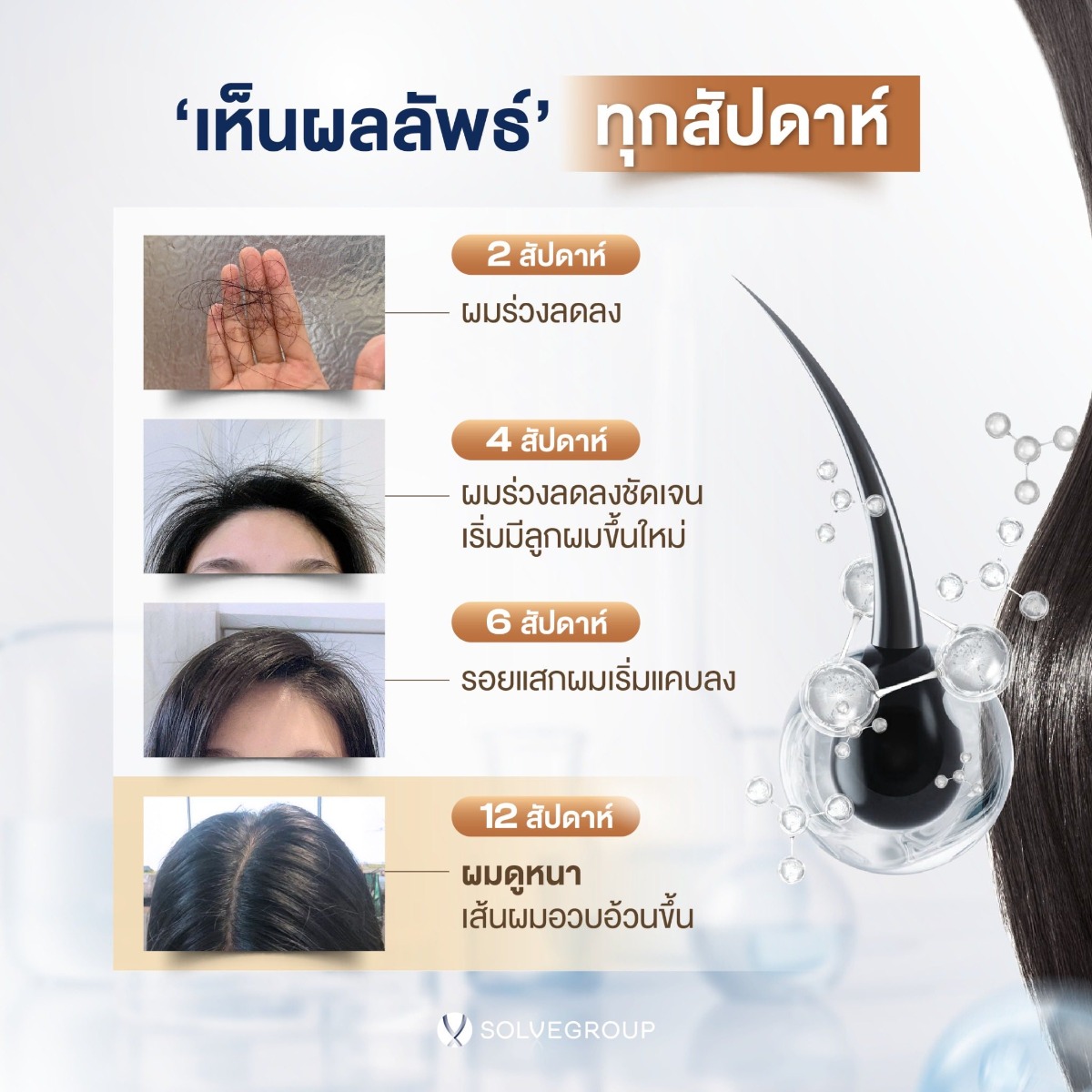 เซตลดผมร่วง ผมบาง เพิ่มการงอกใหม่ของเส้นผม Solve Hair Full Set