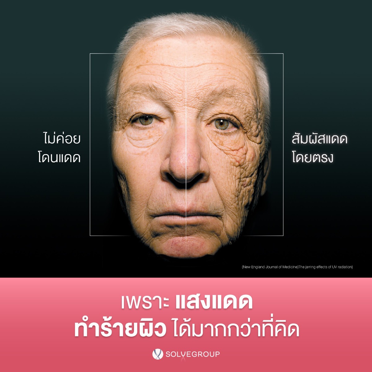 ไม่ว่าจะเป็น • ฝ้า กระ จุดด่างดำ • ผิวหมองคล้ำ • ริ้วรอย • รูขุมขนกว้าง • ผิวแห้งขาดน้ำ ไม่ว่าจะเป็น • ฝ้า กระ จุดด่างดำ • ผิวหมองคล้ำ • ริ้วรอย • รูขุมขนกว้าง • ผิวแห้งขาดน้ำ