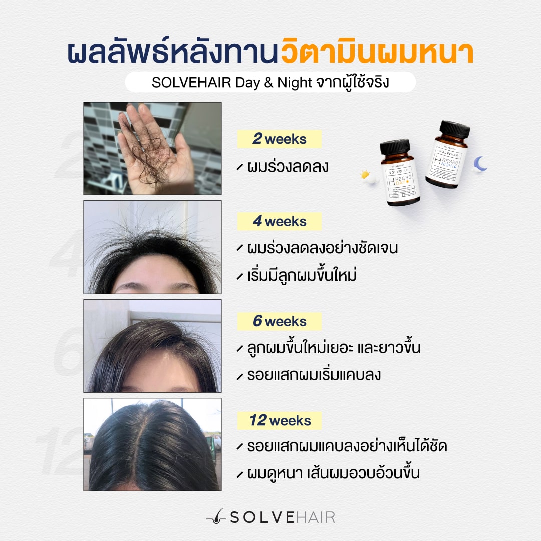 ผมร่วงลดลง ลูกผมขึ้นใหม่ ผมดูหนาขึ้น รีวิวSOLVEHAIR จากผู้ใช้จริง