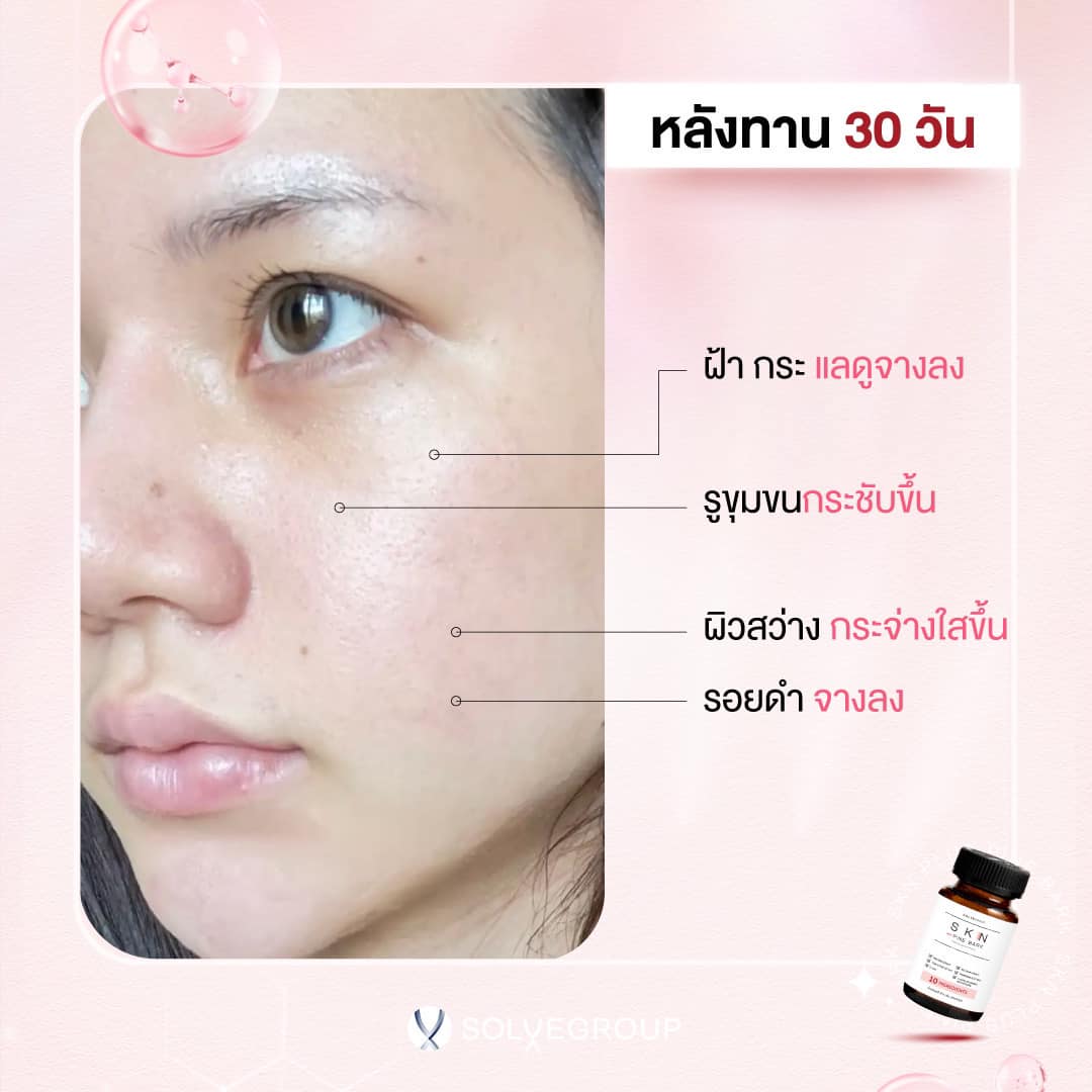 หลังทาน 30 วัน