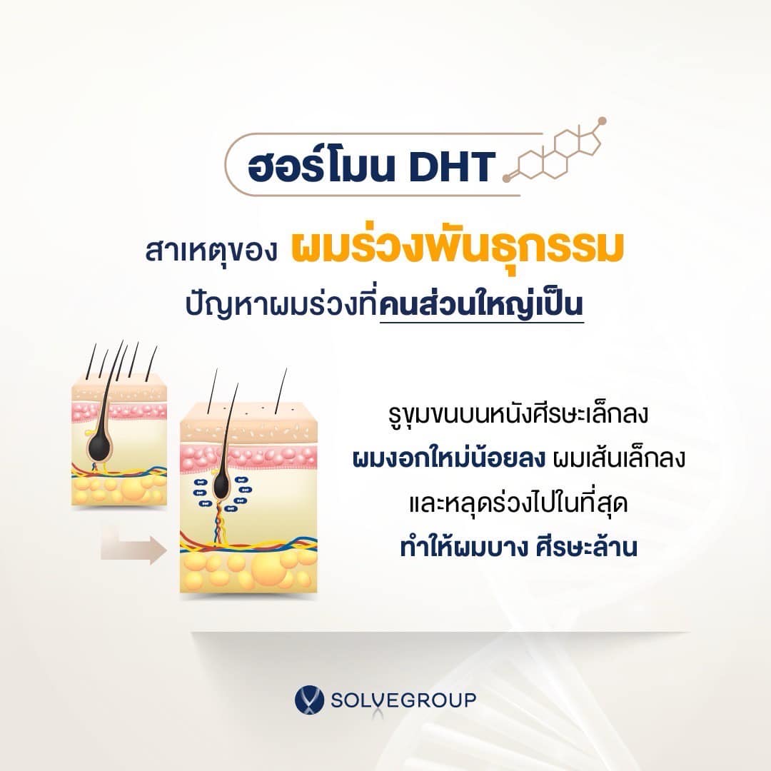 ฮอร์โมน DHT