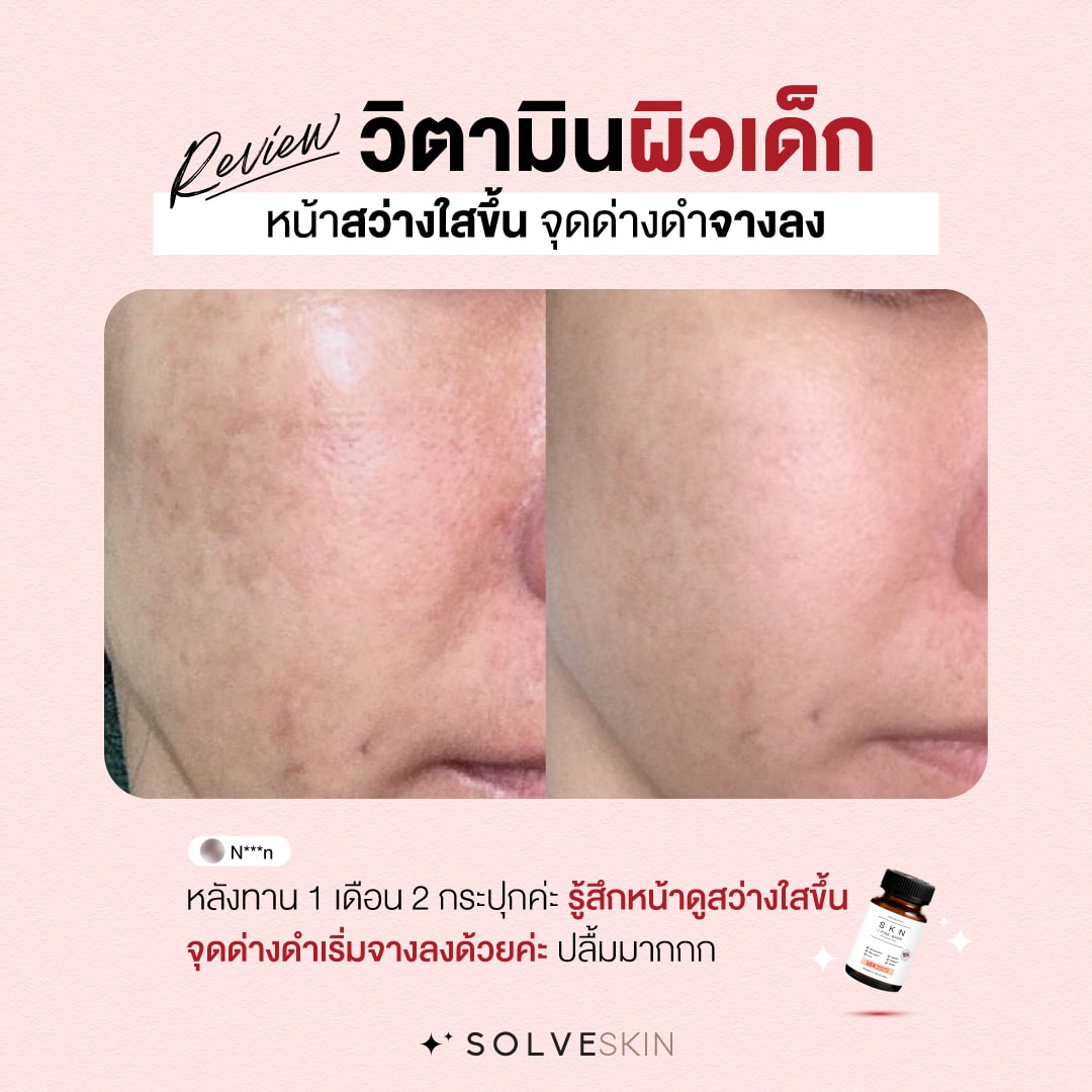 Review วิตามินผิวเด็ก SKN plus pine bark