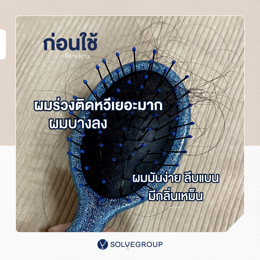 รีวิว ก่อนใช้ SolveHair : ผมร่วงติดหวีเยอะมาก ผมบางลง และ ผมมันง่าย ลีบแบน มีกลิ่นเหม็น