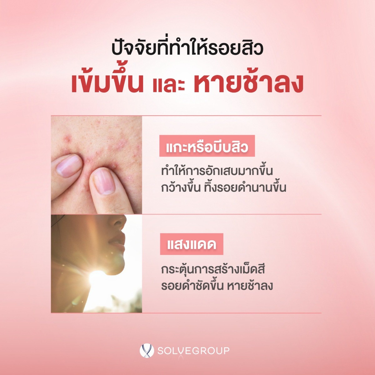 ปัจจัยที่ทำให้รอยสิว เ ปัจจัยที่ทำให้รอยสิว เ