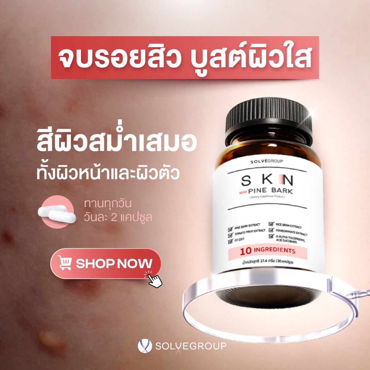 SKN วิตามินผิวยืน 1 SKN วิตามินผิวยืน 1