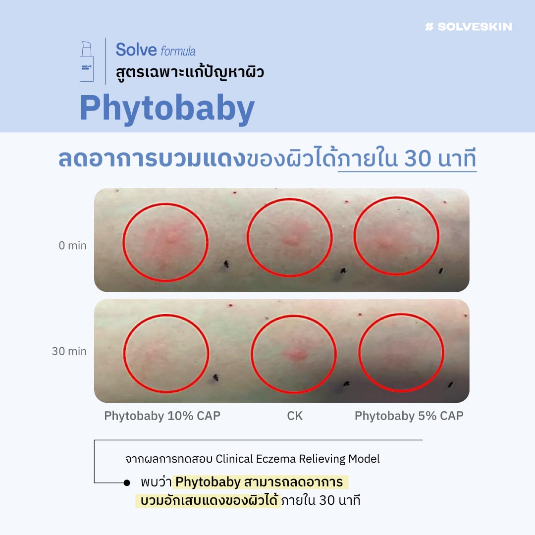 Solve formula สูตรเฉพาะแก้ปัญหาผิว Phytobaby ลดอาการบวบแดง บวกอักเสบแดงของผิวได้ภายใน 30 นาที