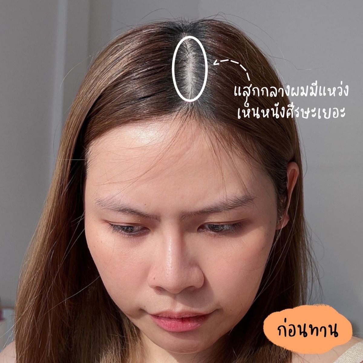 นาแนนป้ายยา รีวิว หลังใช้