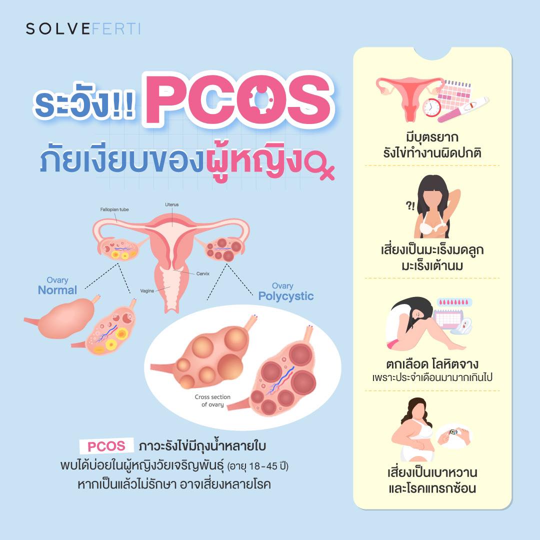 4 อาการ PCOS ภัยเงียบของผู้หญิง