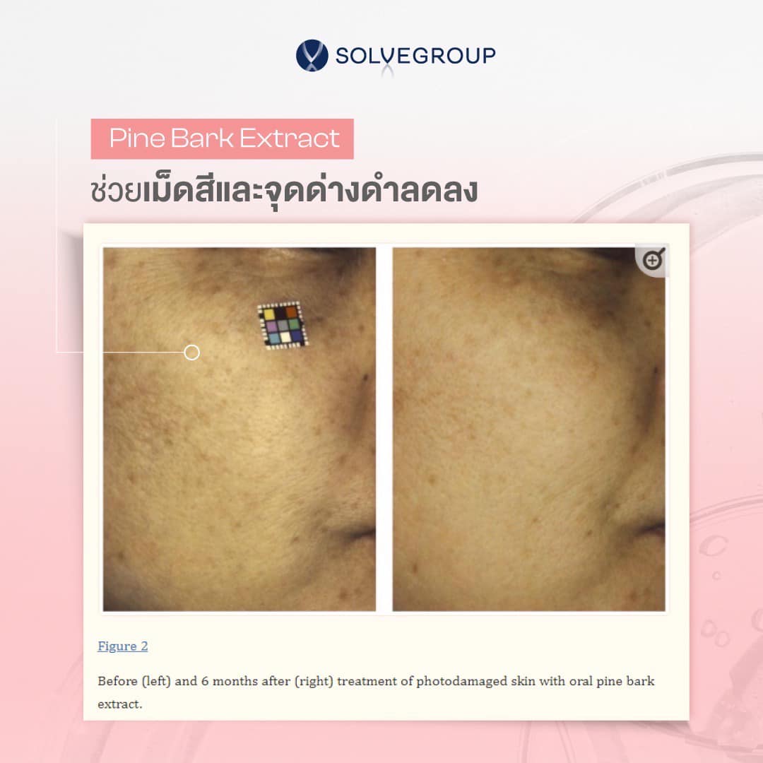 SOLVEGROUP Pine Bark Extract ช่วยเม็ดสีและจุดด่างดำลดลง