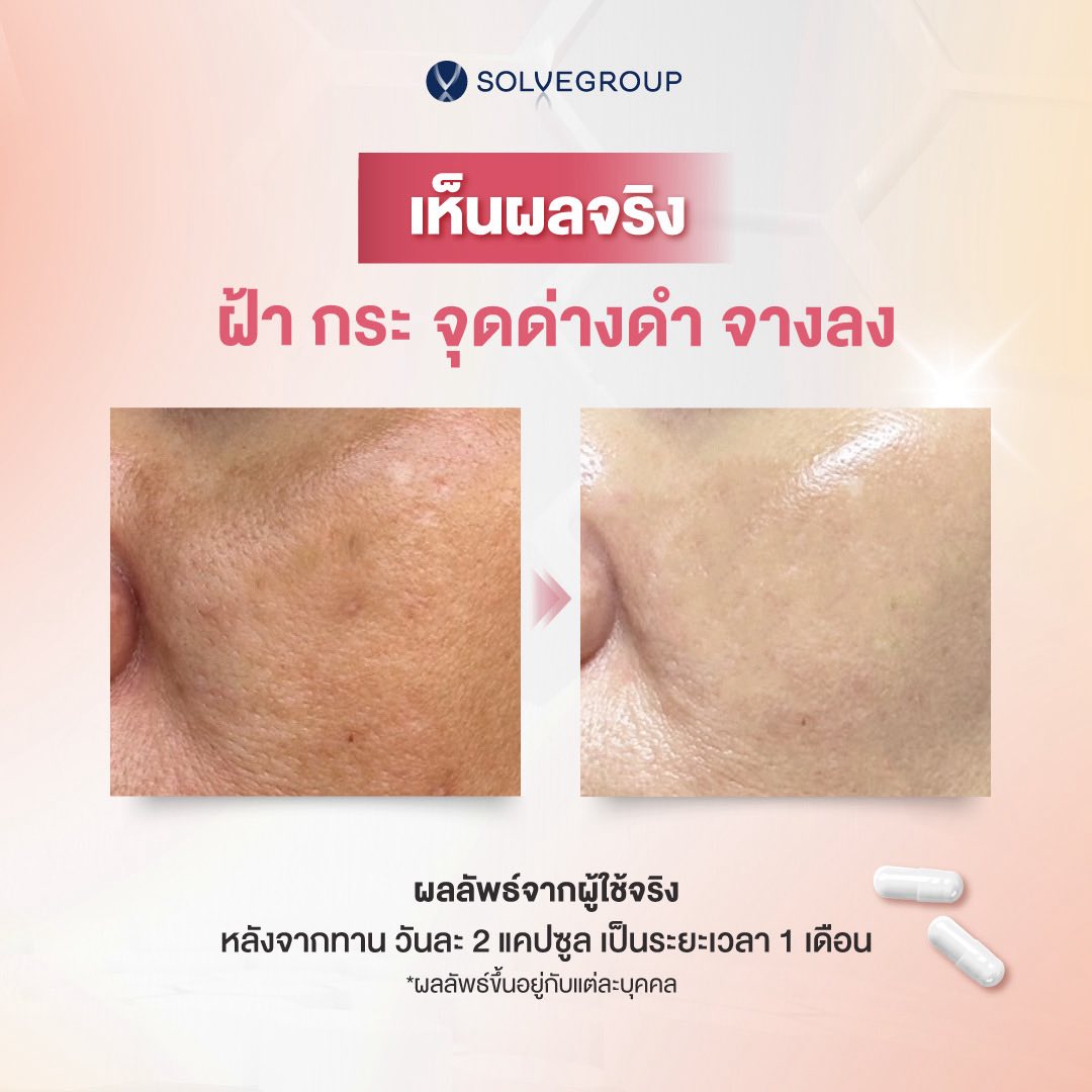 PYCNOGENOL สารสกัดจากเปลือกสนฝรั่งเศส PYCNOGENOL สารสกัดจากเปลือกสนฝรั่งเศส