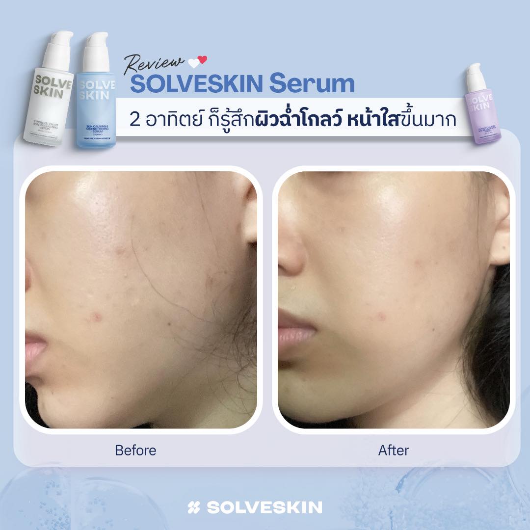 Review SolveGroup Serum 2 อาทิตย์ ก็รู้สึกผิวฉ่ำโกลว์ หน้าใสขึ้นมาก