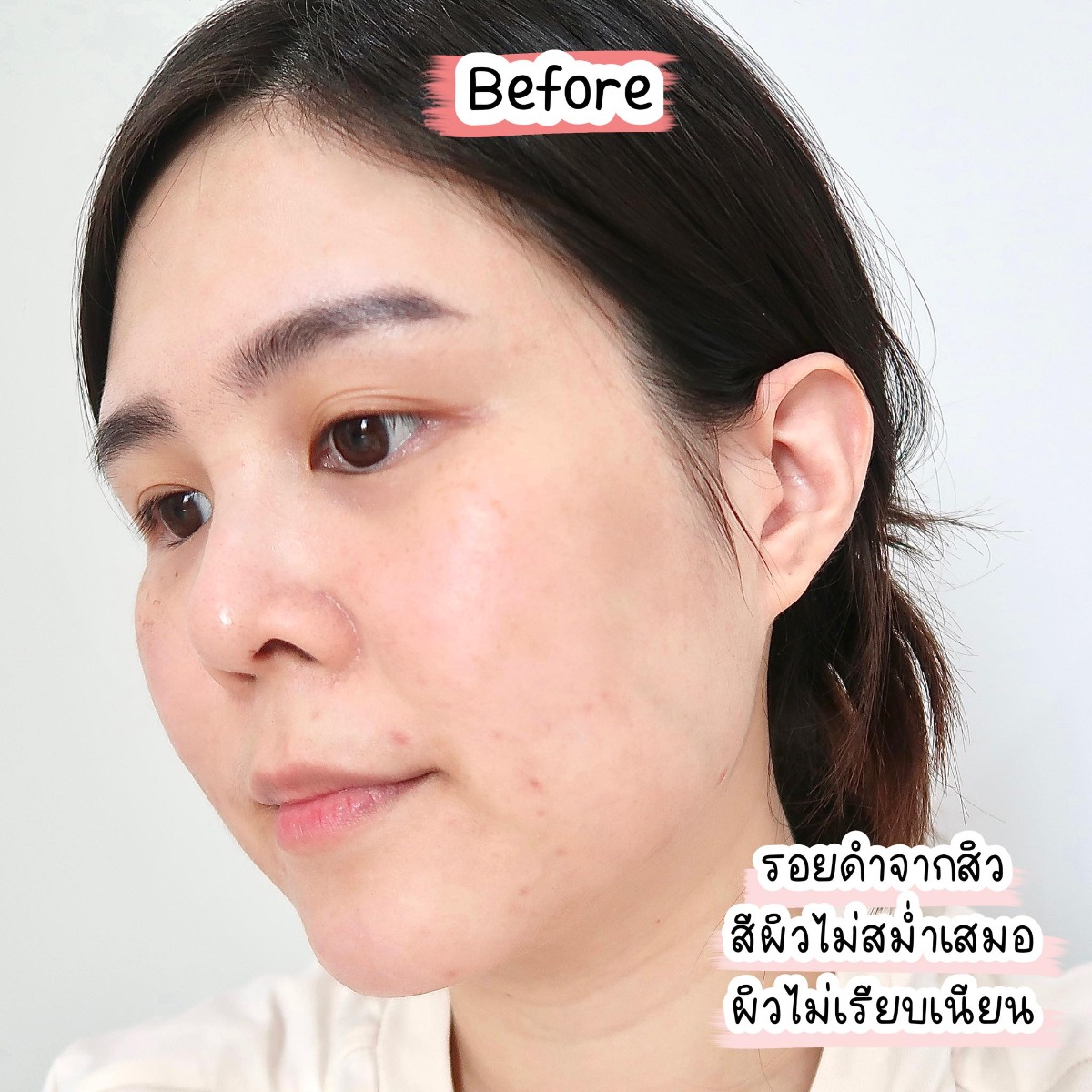 Eye Style รีวิว SKN Plus Pine Bark วิตามินกันผิวแก่