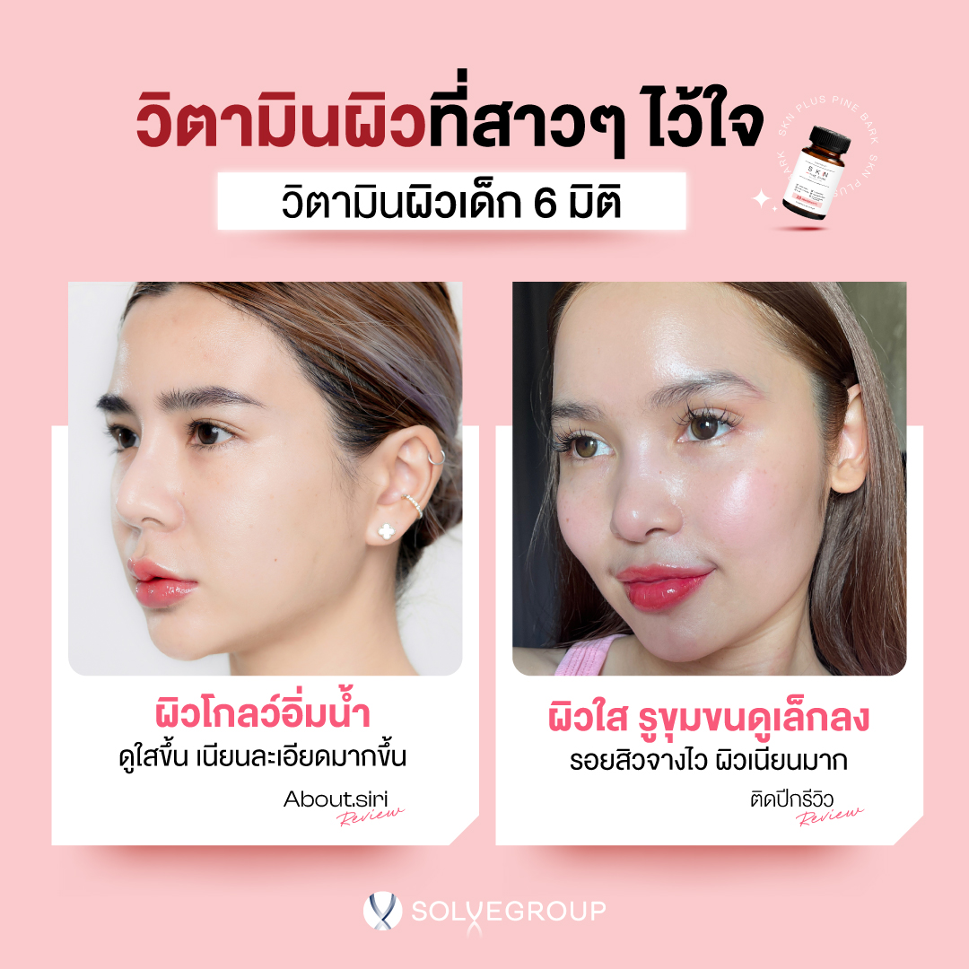 วิตามินผิว ที่สาวๆไว้ใจ วิตามินผิวเด็ก 6 มิติ