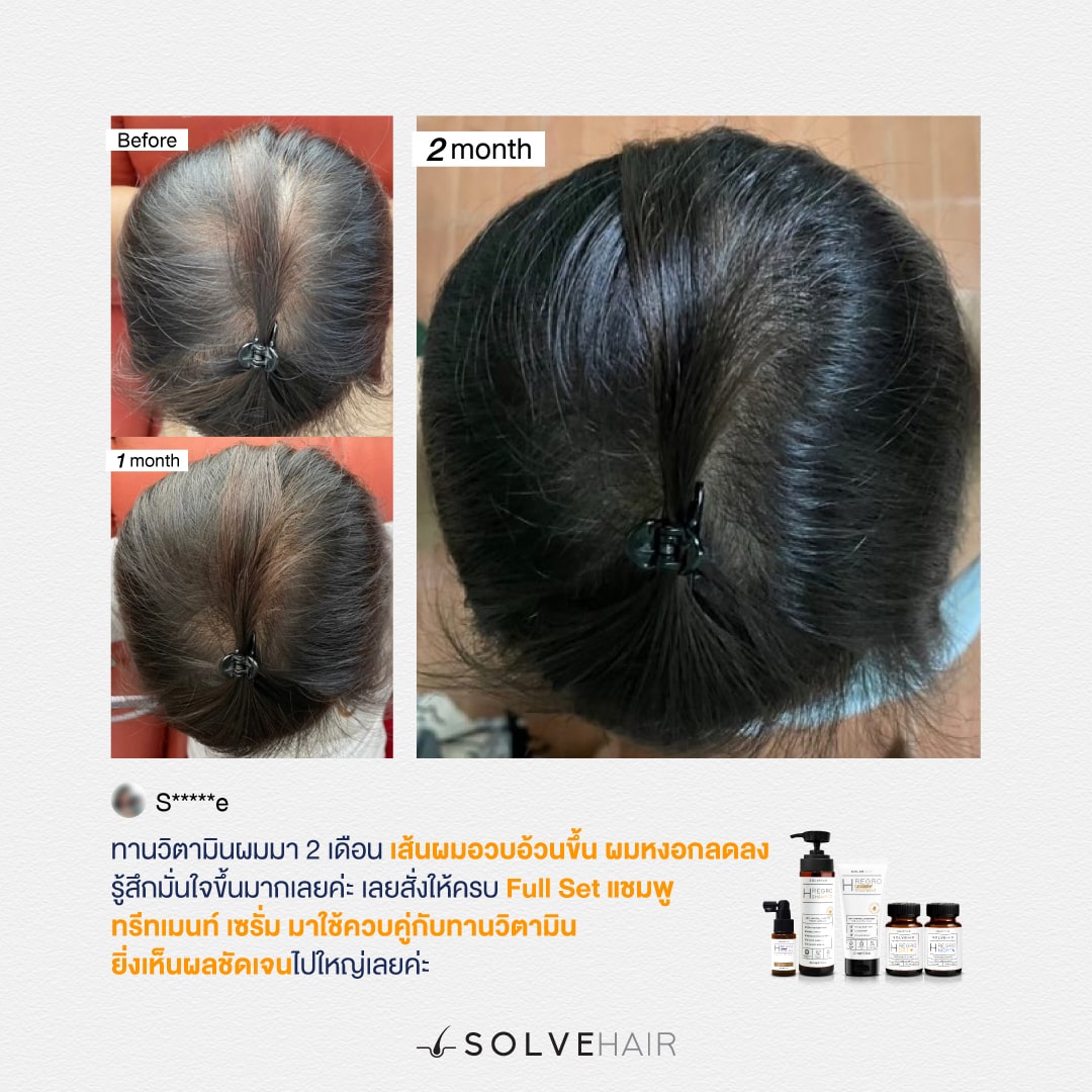 เรื่องของผม ต้องจบที่ SOLVEHAIR รีวิวSOLVEHAIR ที่ผู้ใช้จริงอยากบอกต่อ