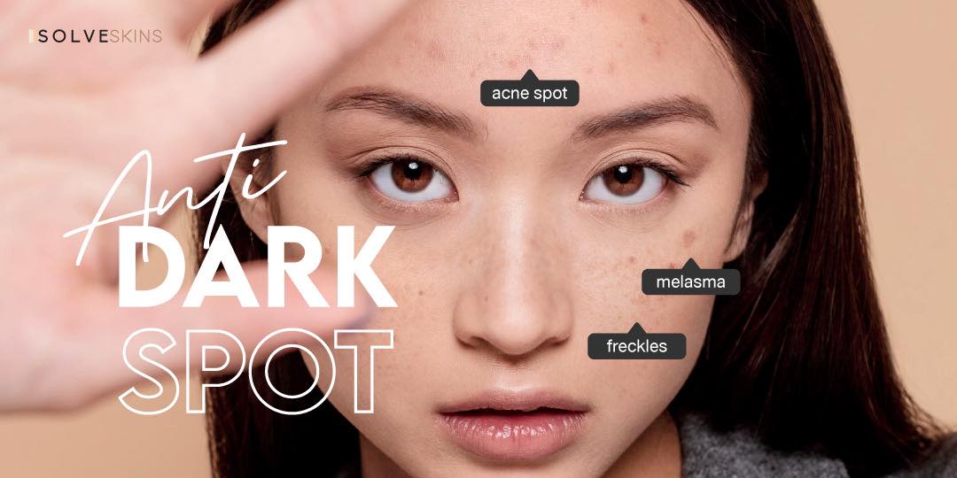 Anti dark spot ลดเลือนฝ้าฝังลึก กระ จุดด่างดำ รอยดำรอยแดงจากสิว ด้วยสารสกัดจาก Pearl Tomato