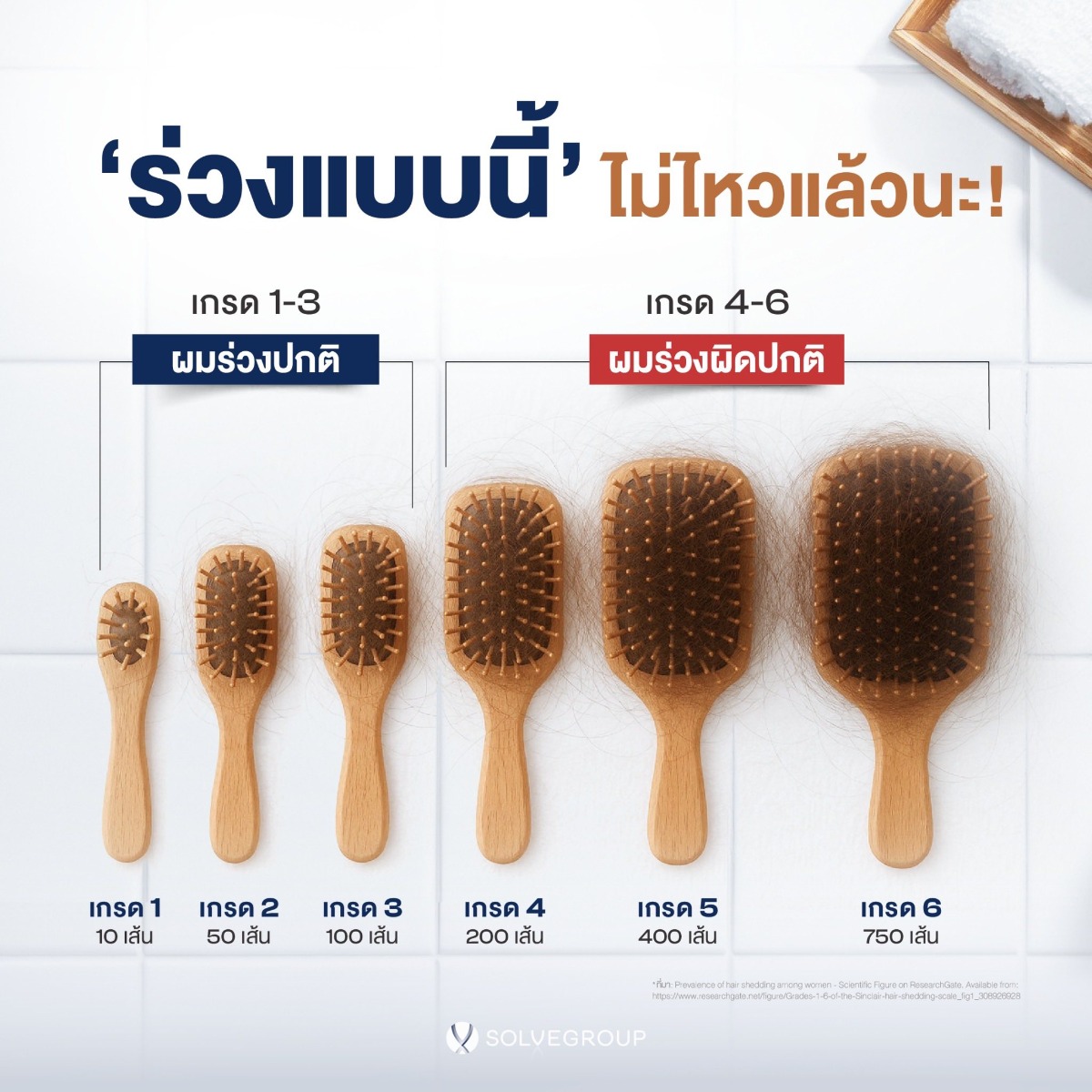 หยุดผมร่วง ก่อนผมล้าน ผมร่วง แบบไหน เรียกว่า ร่วงผิดปกติ? มาลองเช็กกัน ผมร่วง ใครอยู่เกรดไหน คอมเม้นท์มาบอกกันได้นะคะ