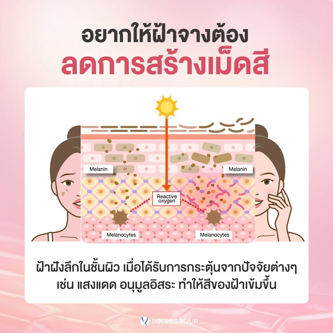อยากให้ฝ้าจางต้อง ลดการสร้างเม็ดสี ฝ้าฝั่งลึกในชั้นผิว เมื่อได้รับการกระตุ้นจากปัจจัยต่างๆ เช่น แสงแดด อนุมูลอิสระ ทำให้สีของฝ้าเข้มขึ้น