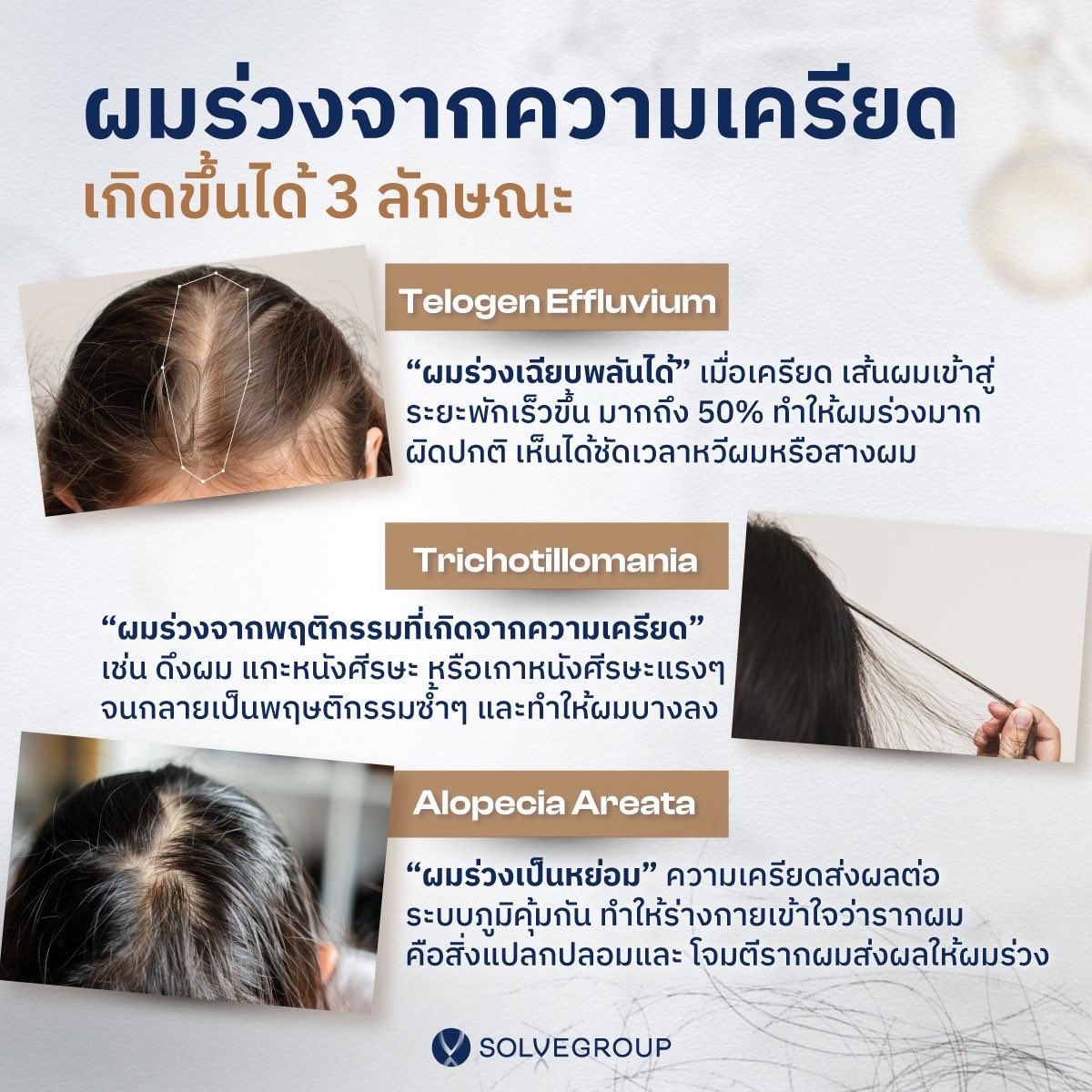 ผมร่วงจากความเครียด