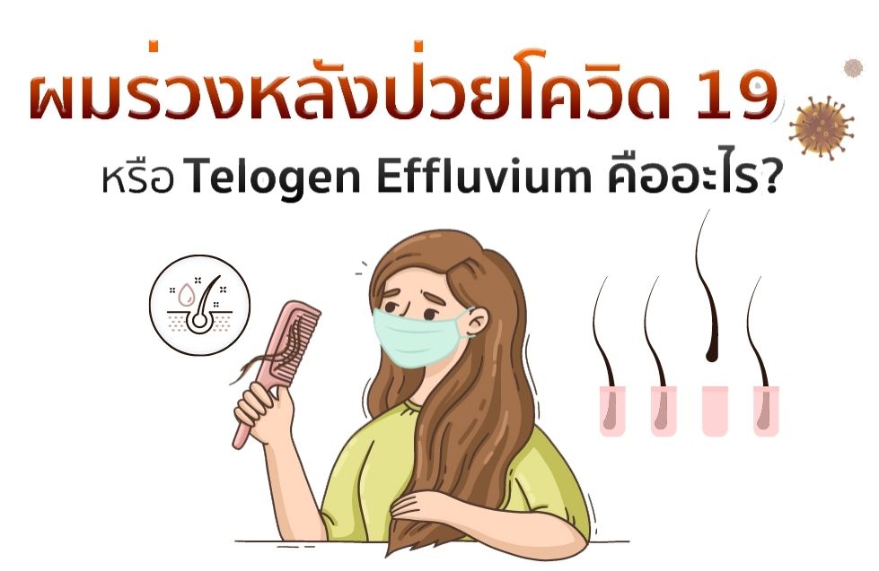 Telogen effluvium