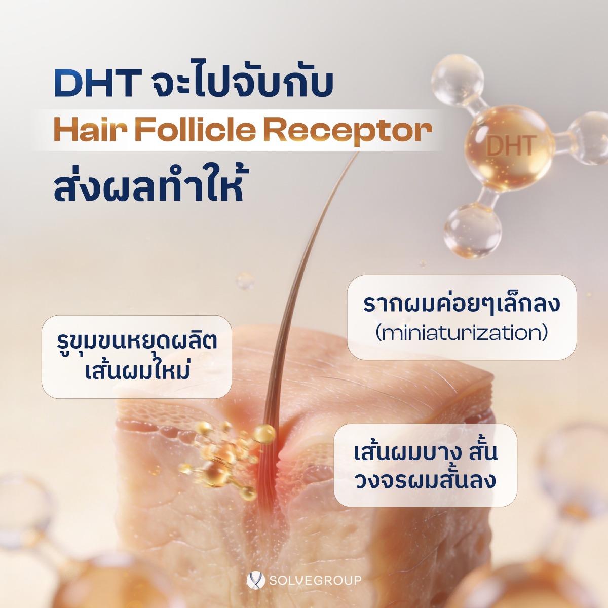 ฮอร์โมน DHT จะไปจับกับตัวรับที่รากผม (Hair Follicle Receptor)