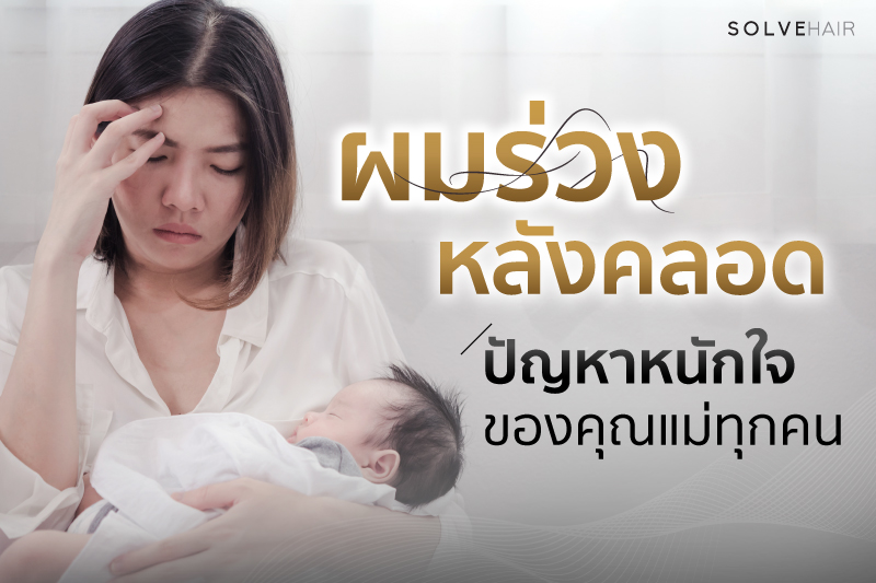 ปัญหาผมร่วงหลังคลอด