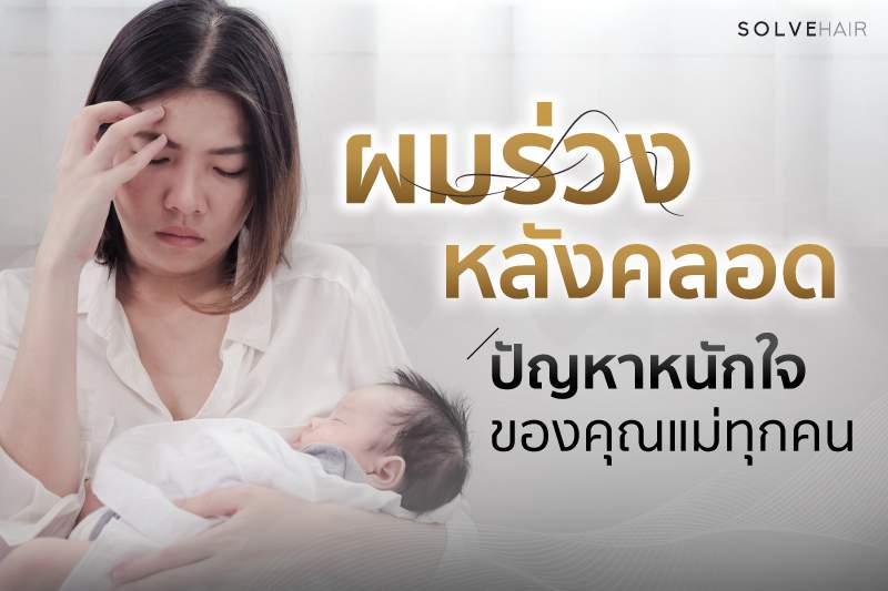 ปัญหาผมร่วงหลังคลอด 