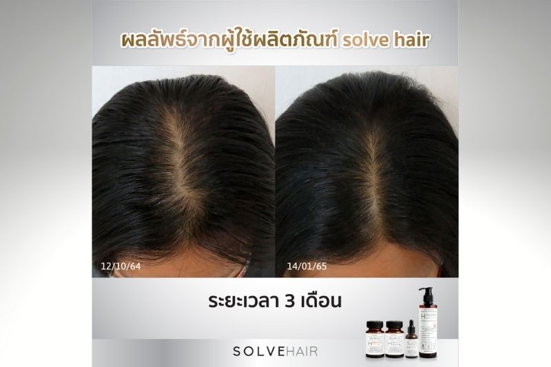 ผลลัพธ์จากผู้ใช้ผลิตภัณฑ์ Solve Hair ระยะเวลา 3 เดือน