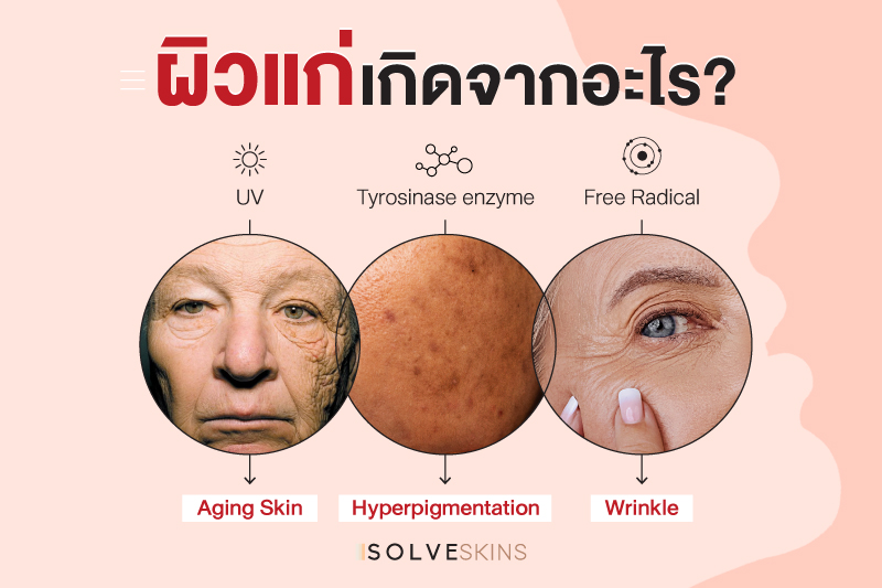 ผิวแก่เกิดจากอะไร