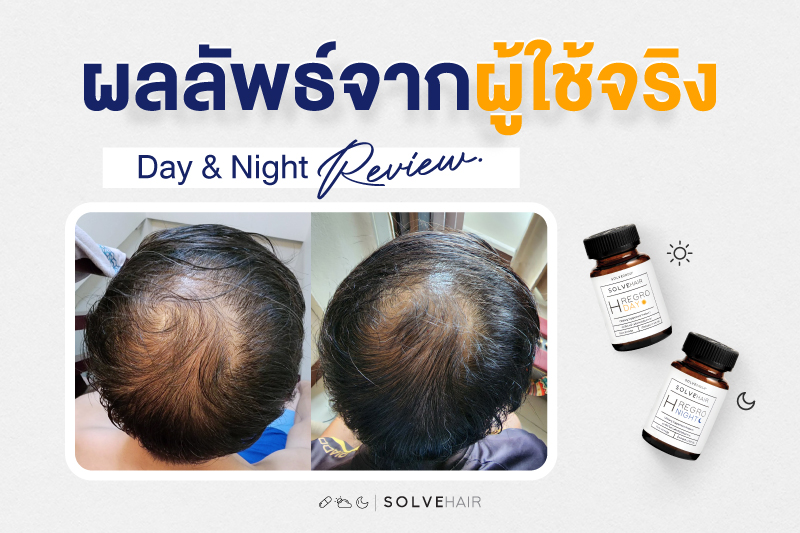 ผลลัพธ์จาก ผู้ใช้จริง วิตามินผม Day & Night Review