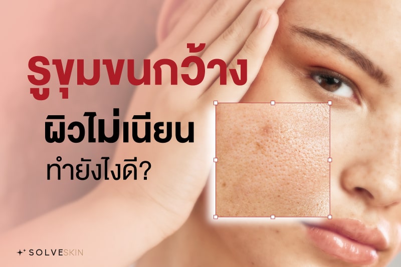 รูขุมขนกว้าง ผิวไม่เนียนทำยังไงดี