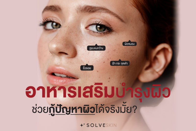 อาหารเสริมบำรุงผิว ช่วยกู้ปัญหาผิวได้จริงมั้ย?