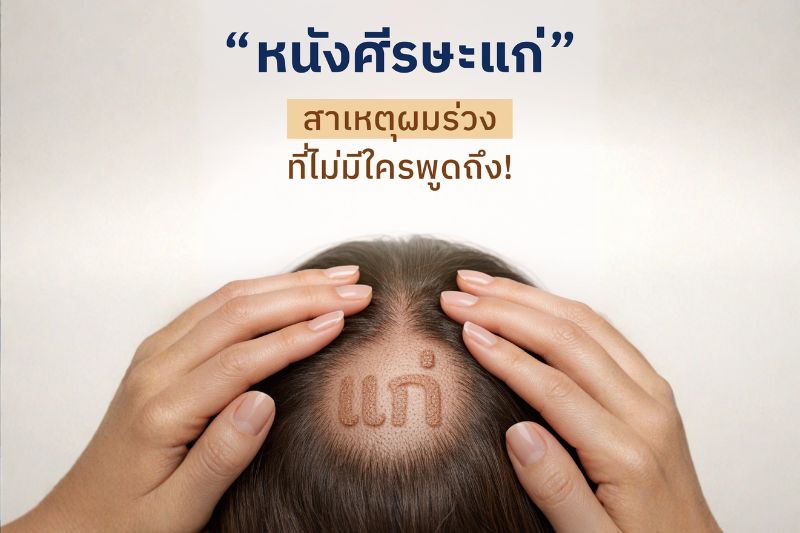 หนังศีรษะแก่ สาเหตุผมร่วงที่ไม่มีใครพูดถึง