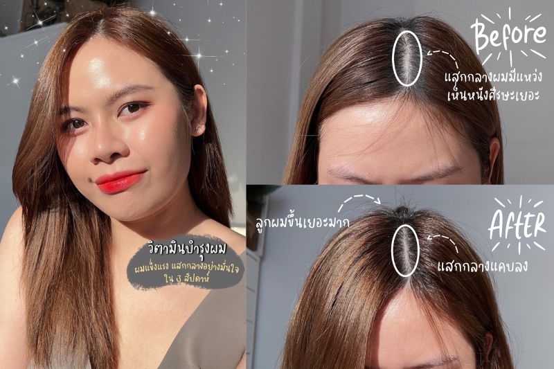 นาแนนป้ายยา รีวิว วิตามินผม Solve Hair Day & Night 3 สัปดาห์