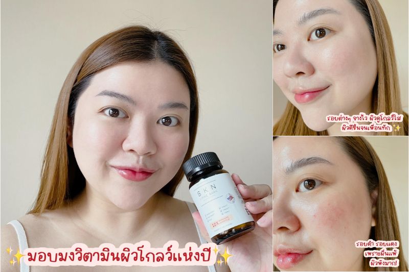 รีวิวจัง วิตามินผิวโกลว์ SOLVE SKN Plus Pine Bark