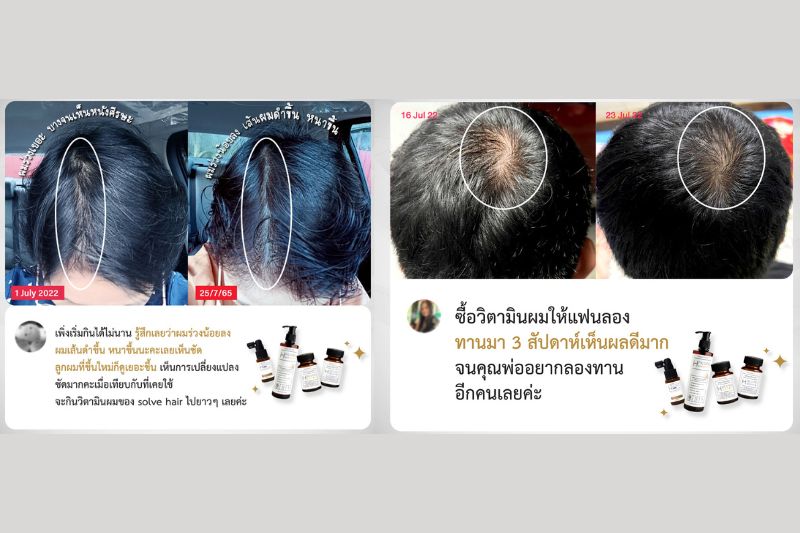 Review ผลลัพธ์จากผู้ใช้งานจริง SolveHair Set