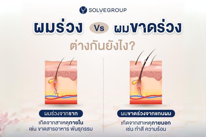 ผมร่วง VS ผมขาดร่วง ต่างกันยังไง? 