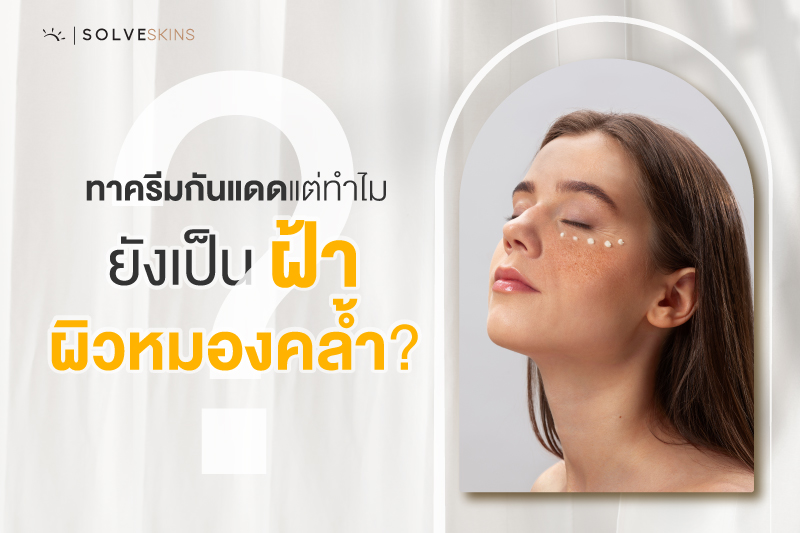 ทาครีมกันแดด แล้วแต่ทำไมหน้ายังเป็นฝ้า ผิวหมองคล้ำ? 