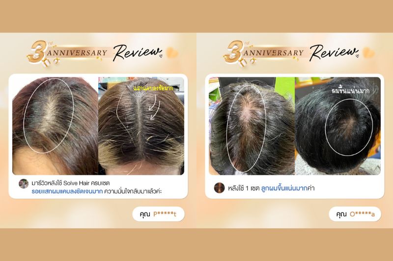 ยินดีกับ ผู้โชคดีทุกคน ที่ได้รับรางวัล SolveHair FullSet 