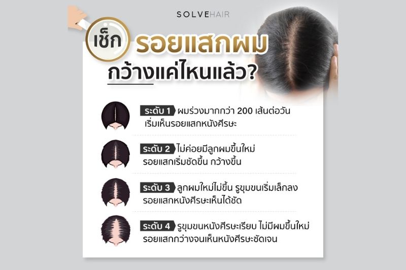 เช็กรอยแสกผม กว้างแค่ไหนแล้ว?