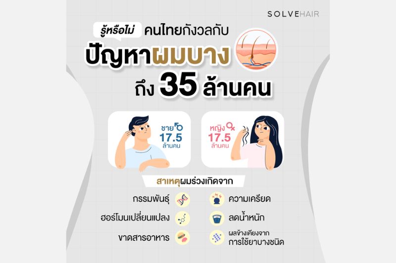 คนไทยกังวล ปัญหาผมบาง ถึง 35 ล้านคน 