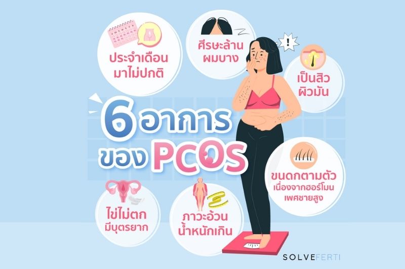 6 อาการของ PCOS