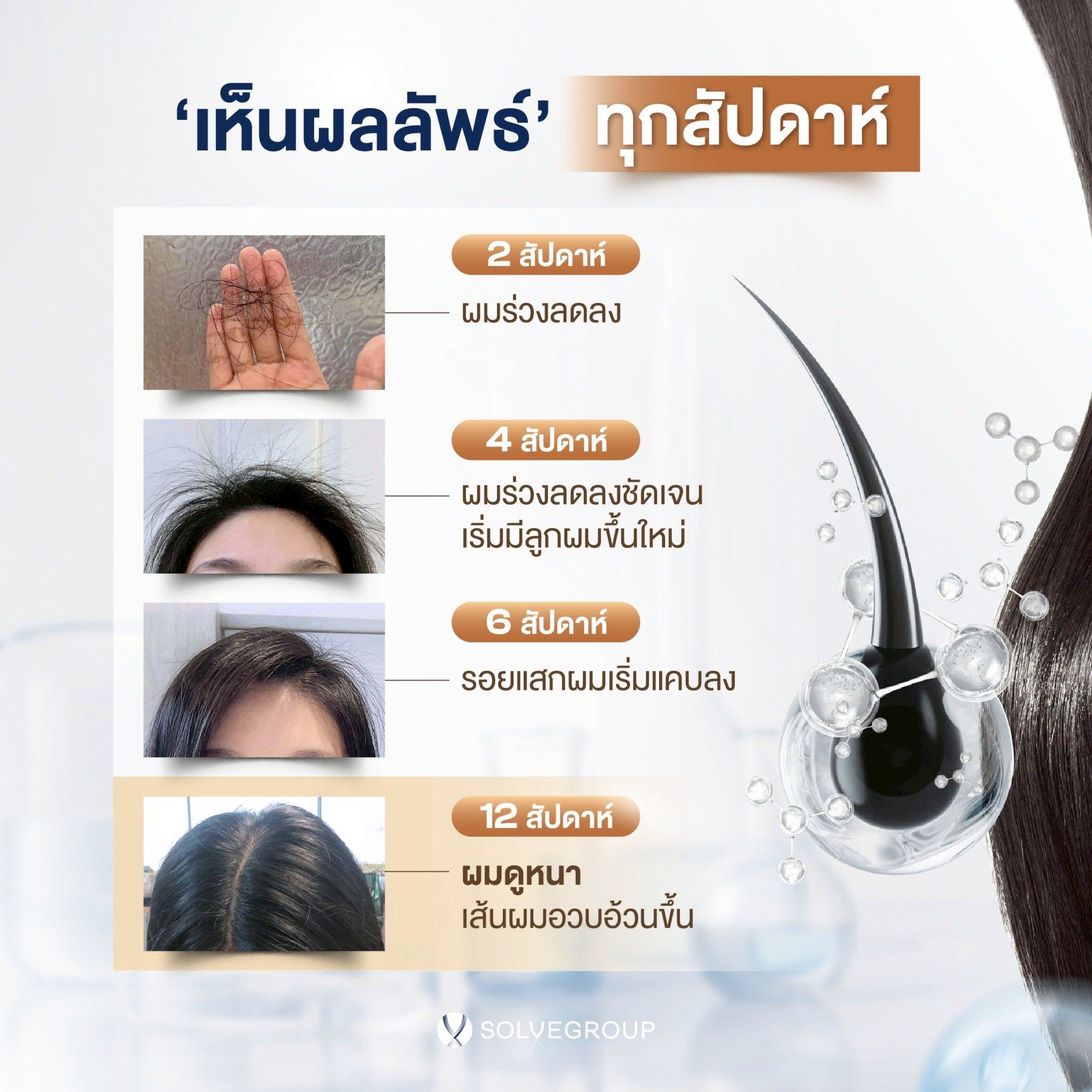 H Regro Day & Night Vitamin วิตามินบำรุงผม สูตรกลางวัน-กลางคืน - Image 3