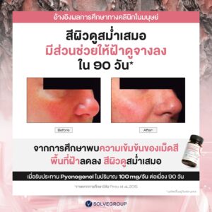Alternative view of Solve Pycnogenol® (พิกโนจีนอล สารสกัดเปลือกสนฝรั่งเศส) + สารสกัดมะเขือเทศ + เซราไมด์จากข้าว