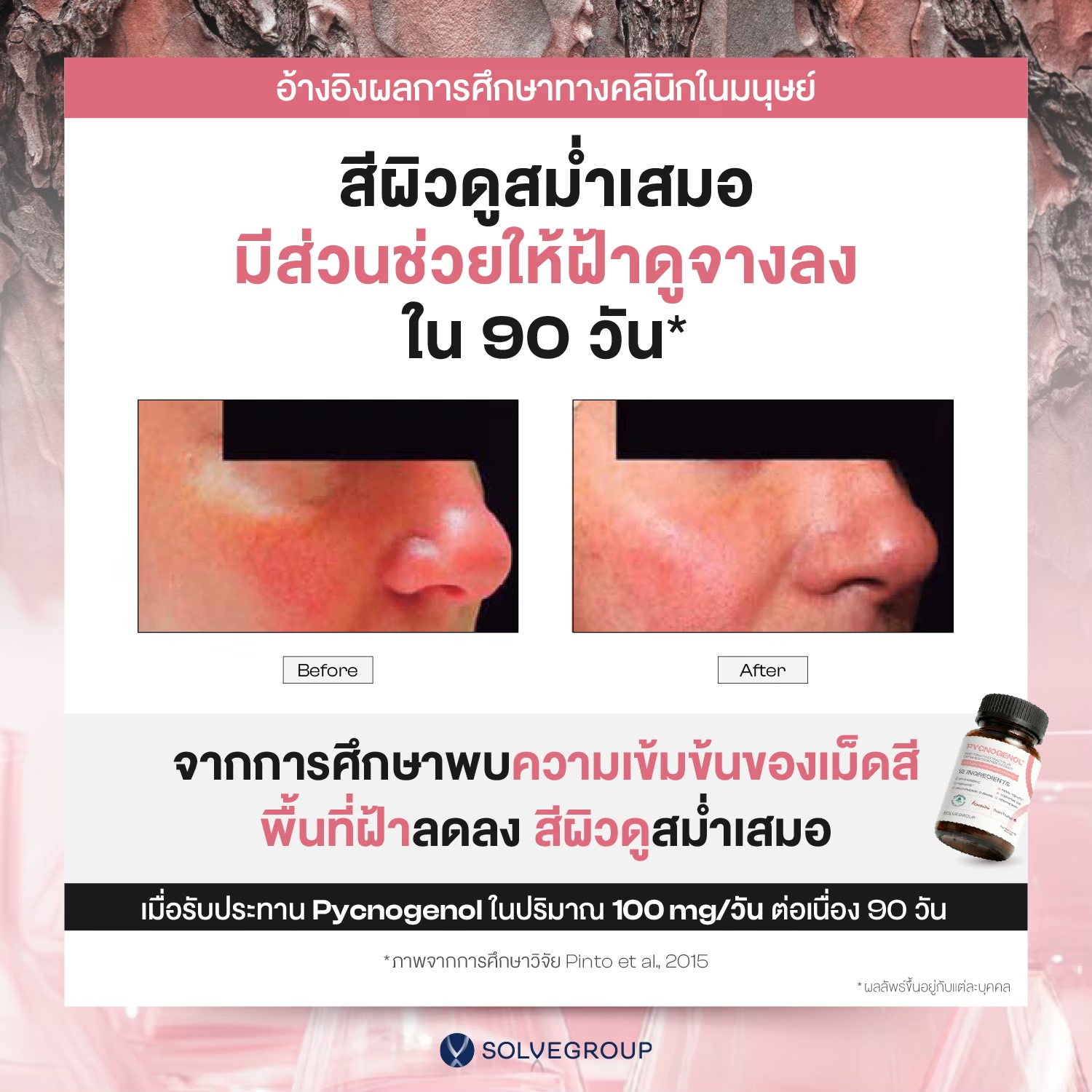 Solve Pycnogenol® (พิกโนจีนอล สารสกัดเปลือกสนฝรั่งเศส) + สารสกัดมะเขือเทศ + เซราไมด์จากข้าว - Image 2